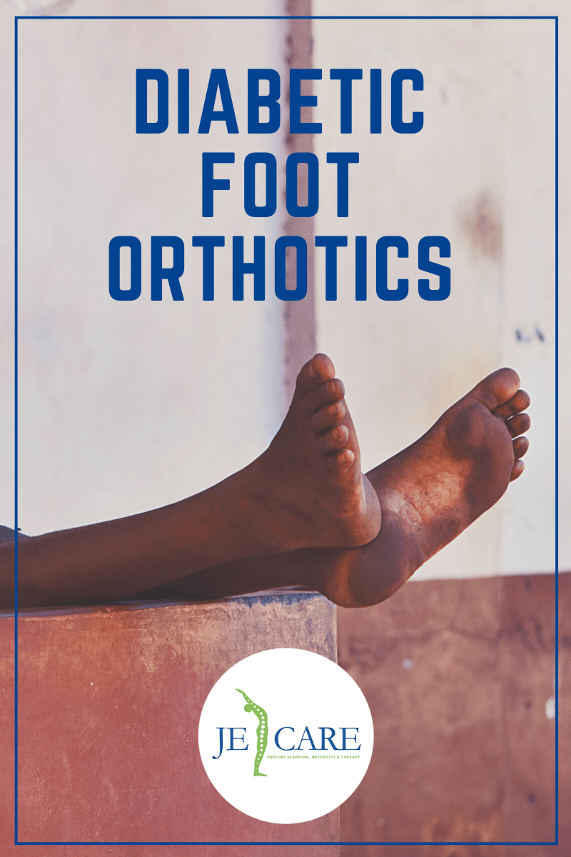 Diabetic foot orthotics JE Care Blog image Chelmsford
